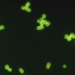 Streptococcus pneumoniae in spinal fluid