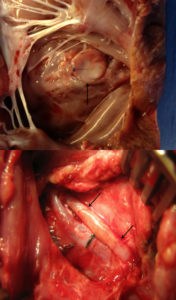 The waterproof, light-activated adhesive can successfully secure biodegradable patches to seal holes in a beating heart (top), as well as seal blood vessels (bottom).