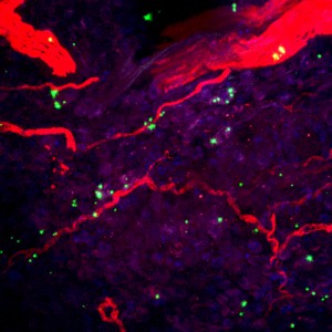 Staph found near fibers from pain neurons