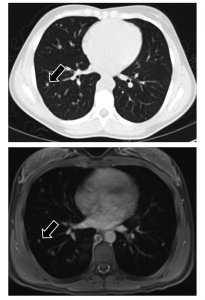 Chest MRI and CT scans from a child