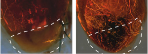 In mice, VEGF-A modRNA visibly improved blood supply to heart muscle (right image).
