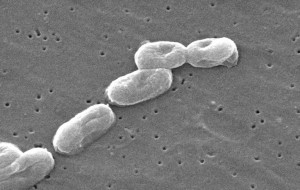 New research may change the way we culture and treat infections. (Burkholderia cepacia complex, CDC/Wikimedia Commons)