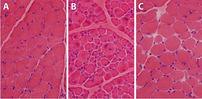 Skeletal muscle from a healthy dog (panel A) contains large, evenly sized muscle fibers with cell nuclei (the blue dots) arranged around their outer edges. In panel B, a dog with MTM shows many smaller muscle fibers with the nuclei abnormally positioned in the center. After gene therapy (panel C), the muscle regains its healthy appearance.  (Courtesy Mike Lawlor, Medical College of Wisconsin.)
