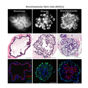 Using a novel 3-D culture method, scientists were able to prod lung (bronchioalveolar) stem cells to produce colonies containing the cell type of choice: airway (bronchiolar) epithelial cells, alveolar epithelial cells or both. (Images: Joo-Hyeon Lee)