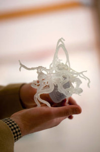 3D printed plastic model of a vein of Galen malformation from a patient's brain Darren Orbach vascular anomalies
