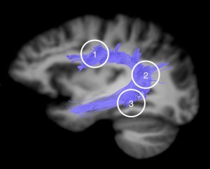 dorsal language circuit updated