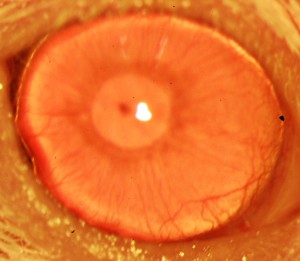 A restored cornea grown from human ABCB5-positive limbal stem cells